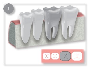 diagnose the problematic tooth diagram